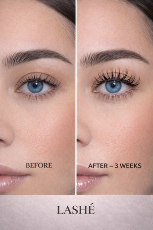 3. See Visible Results in Weeks